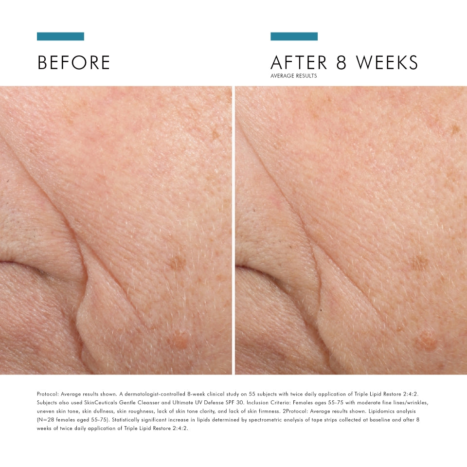 Triple Lipid Restore 2:4:2 SKINCEUTICALS