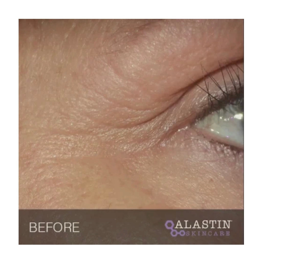 ALASTINE Restorative Eye cream