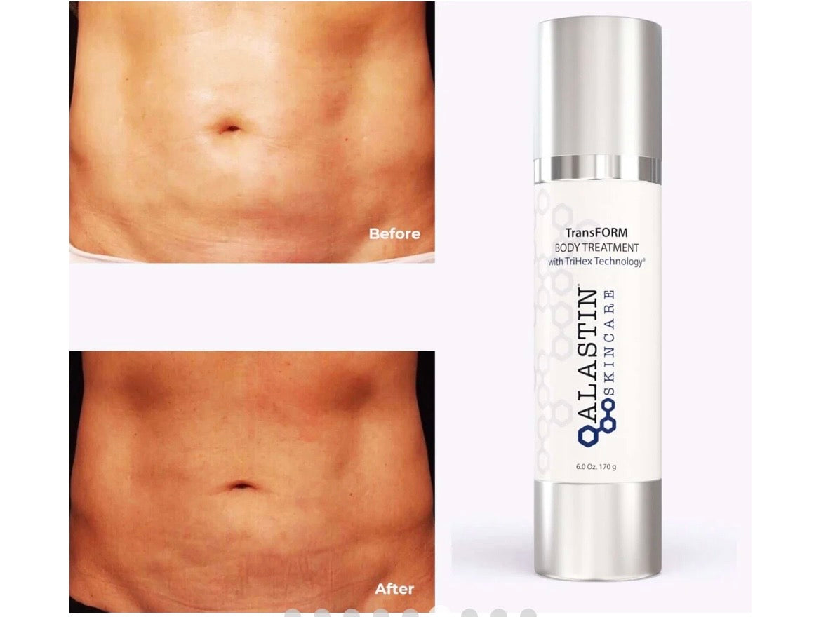 ALASTIN TransFORM Body Complex