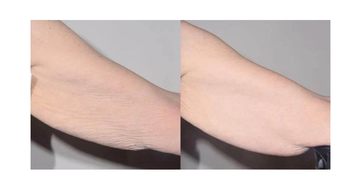 ALASTIN TransFORM Body Complex