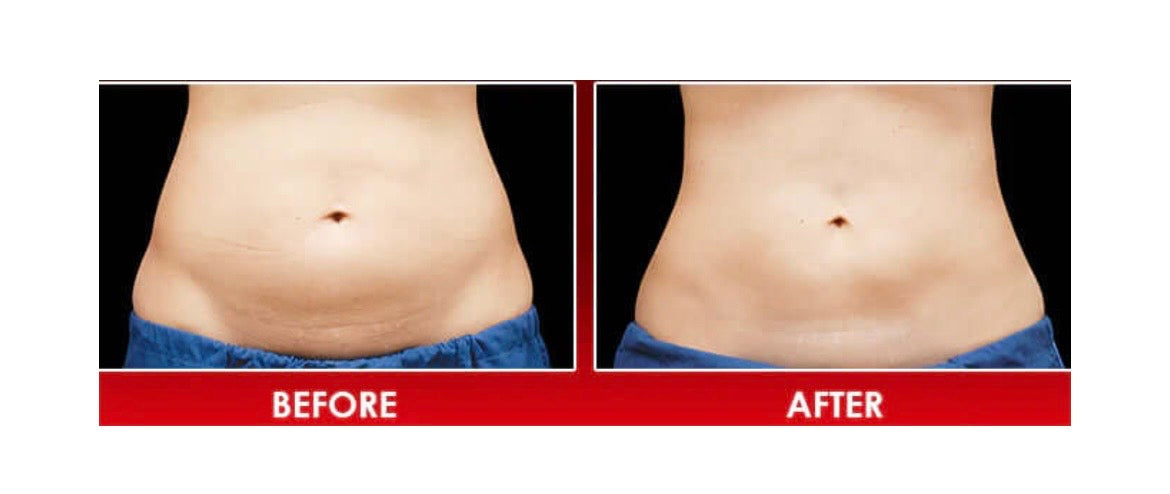 ALASTIN TransFORM Body Complex
