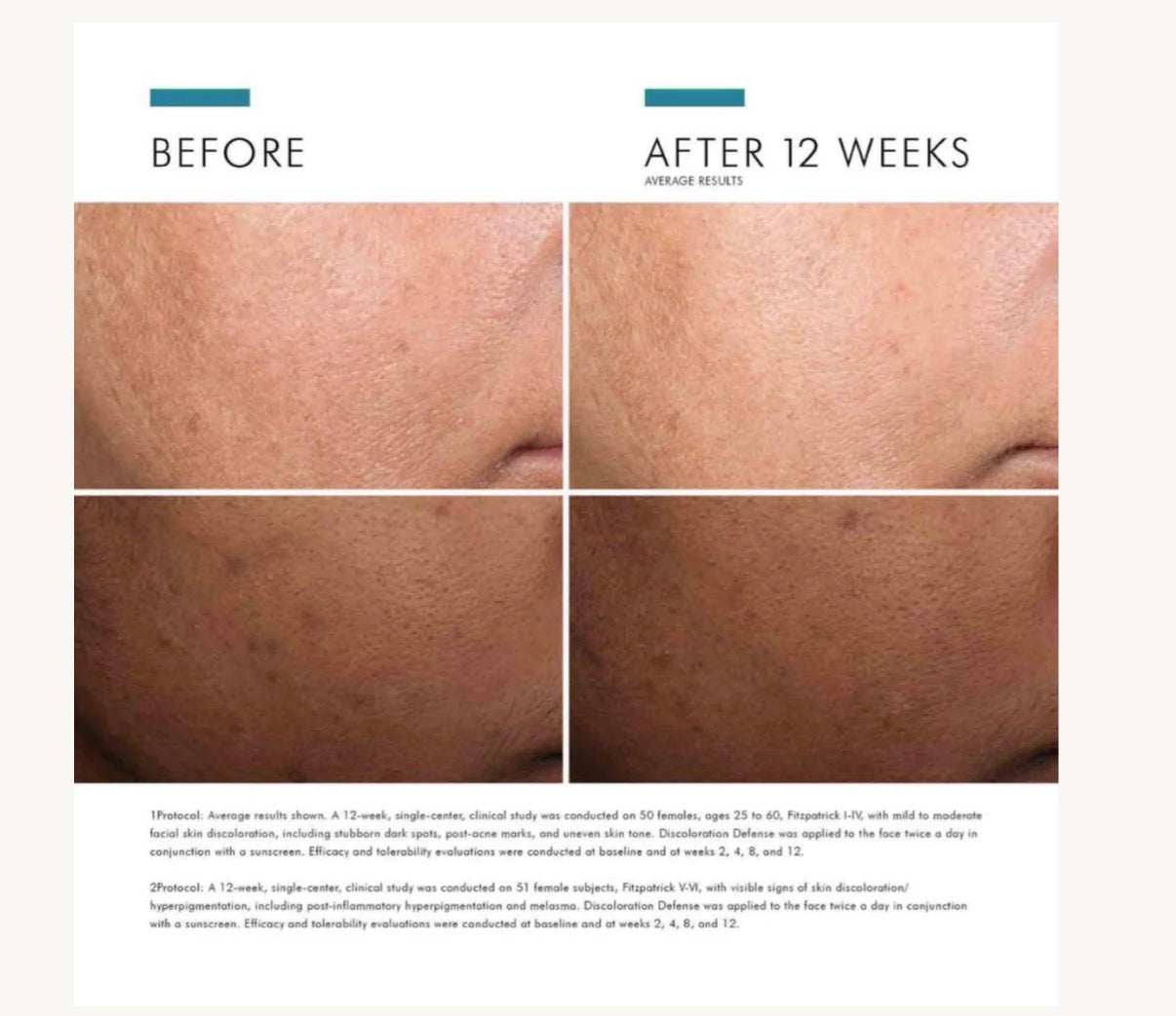 Discolouration Defense SKINCEUTICALS